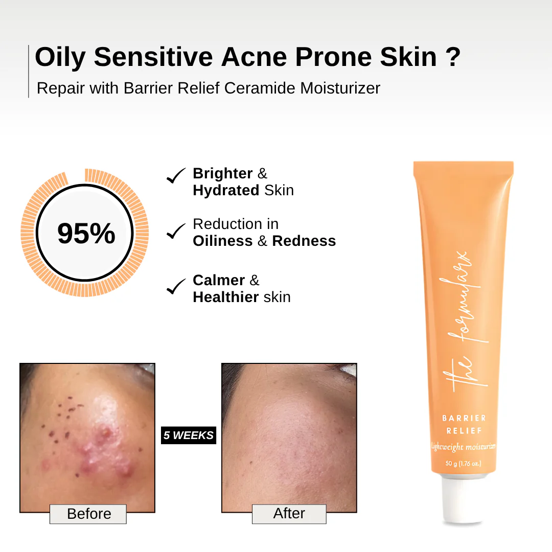 Barrier Relief Lightweight Ceramide  Moisturizer - Image 4