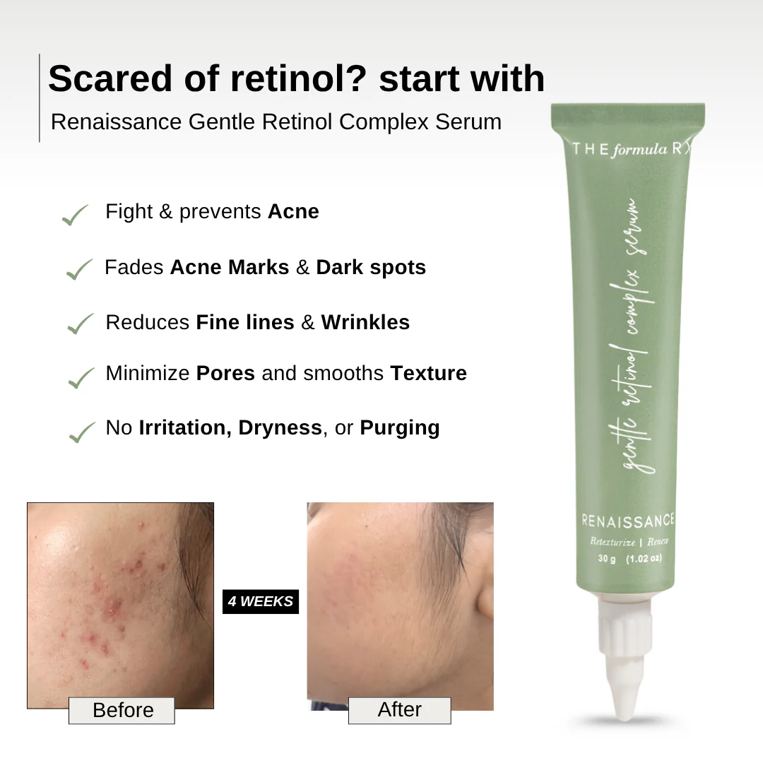 Renaissance Gentle Retinol Complex Serum - Image 4